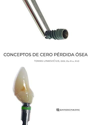 Conceptos de Cero Pérdida Ósea (Spanish Edition) - Tomas Linkevicius