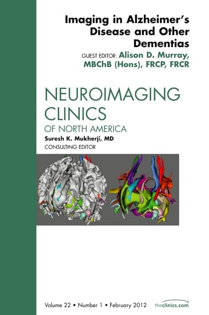 Imaging in Alzheimer’s Disease and Other Dementias, An Issue of Neuroimaging Clinics (Volume 22-1) (The Clinics: Radiology, Volume 22-1)