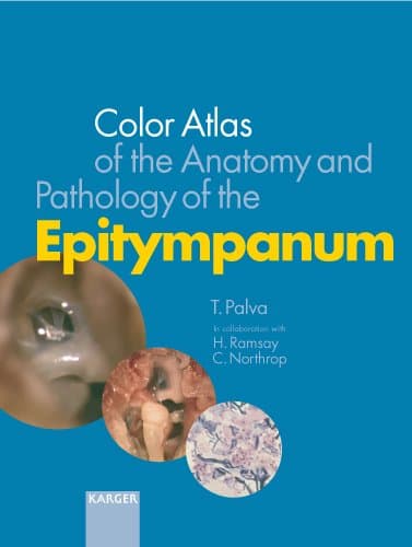 Color Atlas of the Anatomy and Pathology of the Epitympanum - T. Palva