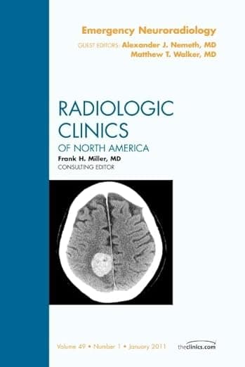 Emergency Neuroradiology, An Issue of Radiologic Clinics of North America (Volume 49-1) (The Clinics: Radiology, Volume 49-1) - Matthew T. Walker MD