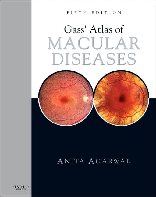 Gass' Atlas of Macular Diseases: 2-Volume Set - Expert Consult: Online and Print - Agar