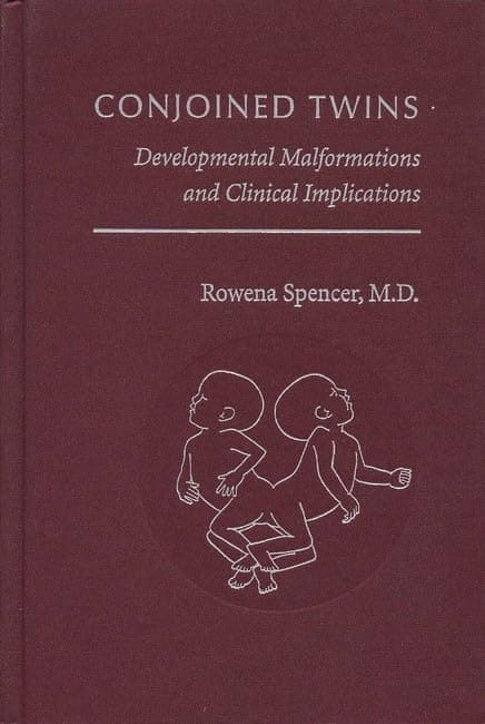 Conjoined Twins: Developmental Malformations and Clinical Implications