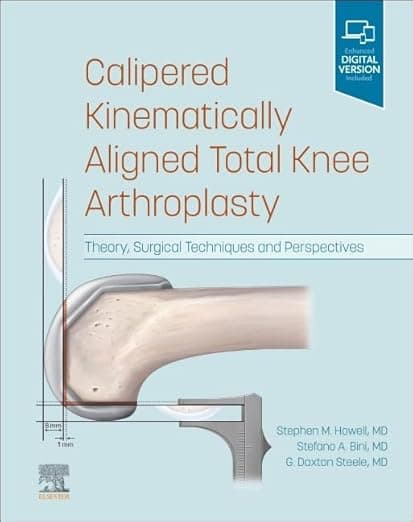 Calipered Kinematically aligned Total Knee Arthroplasty: Theory, Surgical Techniques and Perspectives - Stephen M. Howell MD