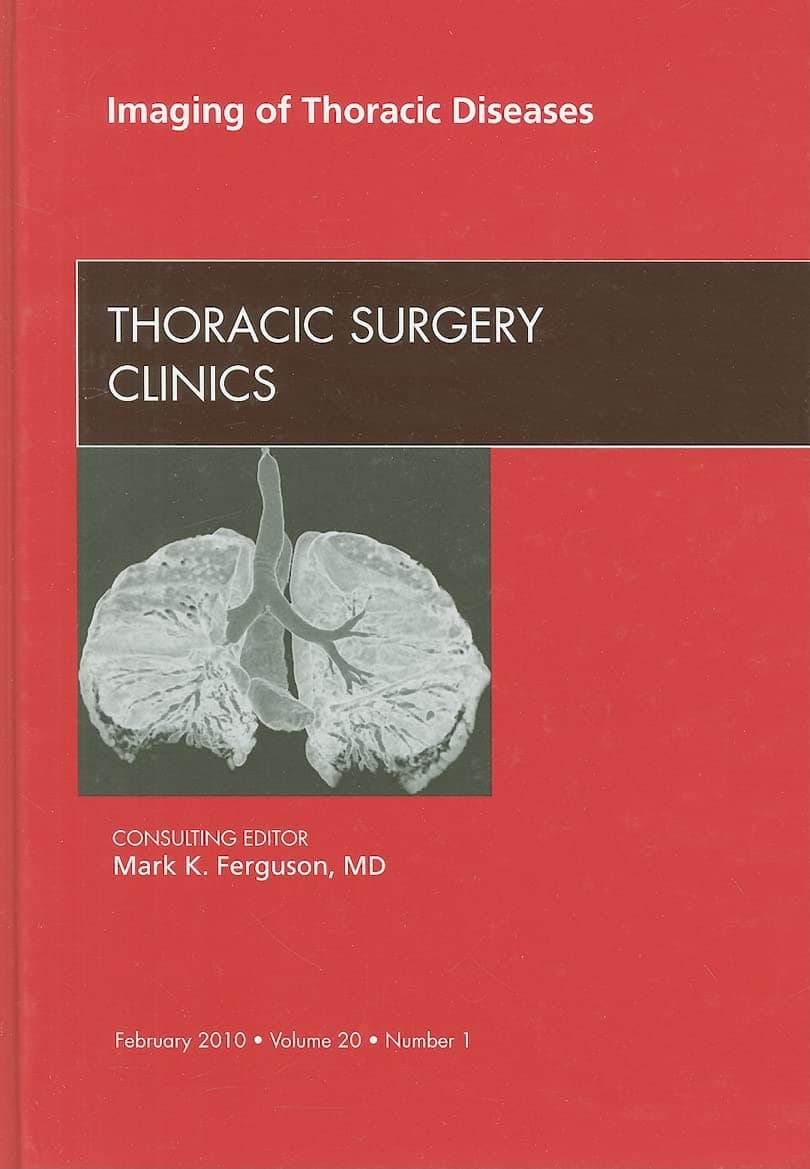 Imaging of Thoracic Diseases, An Issue of Thoracic Surgery Clinics (Volume 20-1) (The Clinics: Surgery, Volume 20-1) - Mark K. Ferguson MD