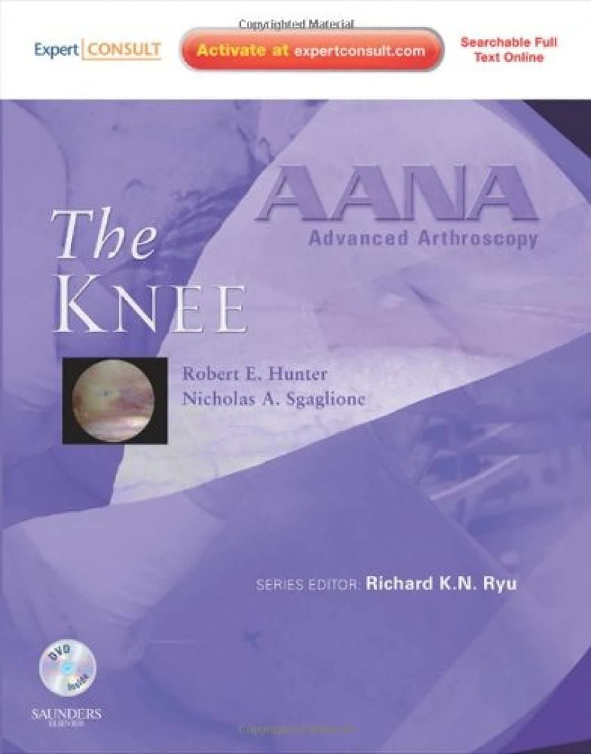 AANA Advanced Arthroscopy: The Knee: Expert Consult: Online, Print and DVD - Robert Hunter