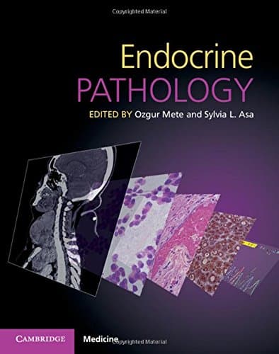 Endocrine Pathology with Online Resource - Ozgur Mete