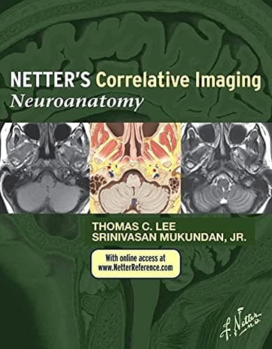 Netter’s Correlative Imaging: Neuroanatomy: with NetterReference.com Access (Netter Clinical Science)