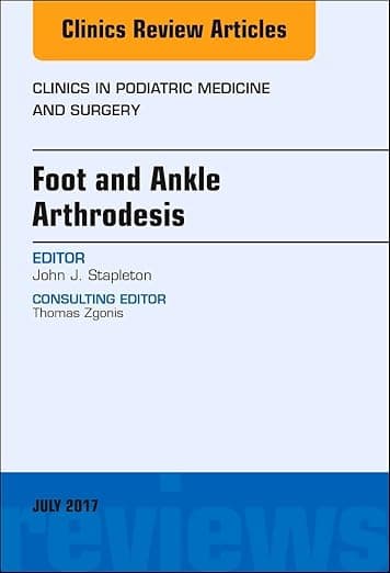 Foot and Ankle Arthrodesis, An Issue of Clinics in Podiatric Medicine and Surgery (Volume 34-3) (The Clinics: Orthopedics, Volume 34-3) - John J. Stapleton DPM