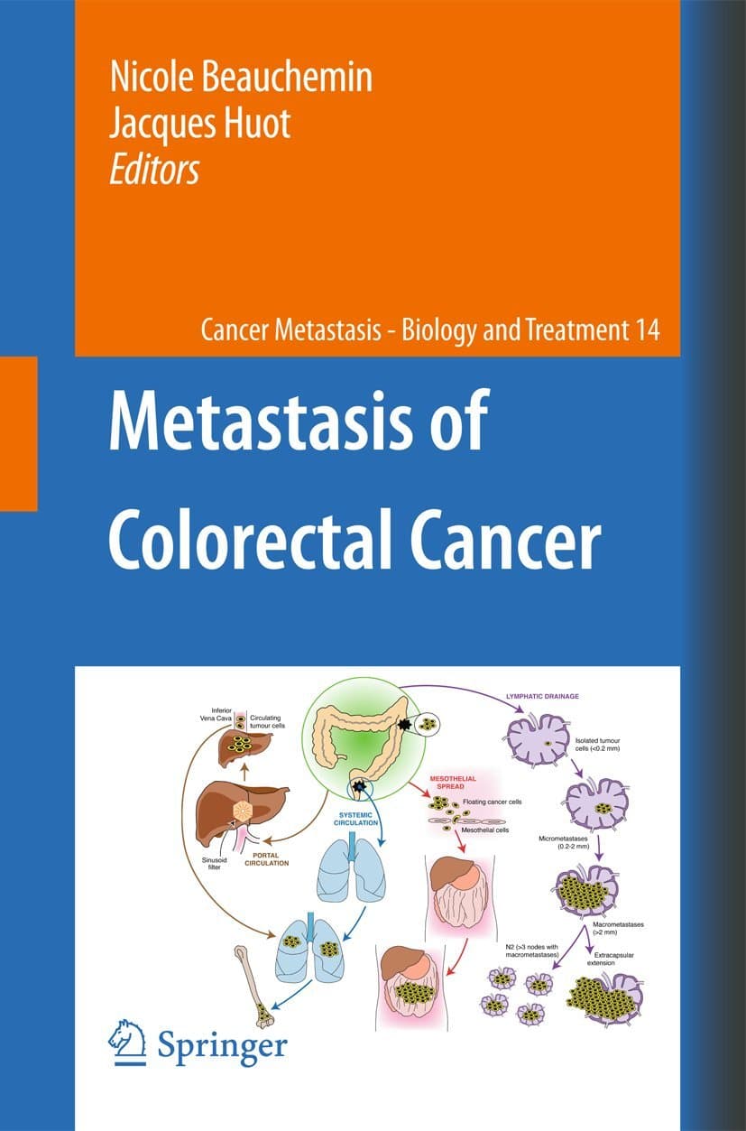 Metastasis of Colorectal Cancer (Cancer Metastasis - Biology and Treatment, 14)