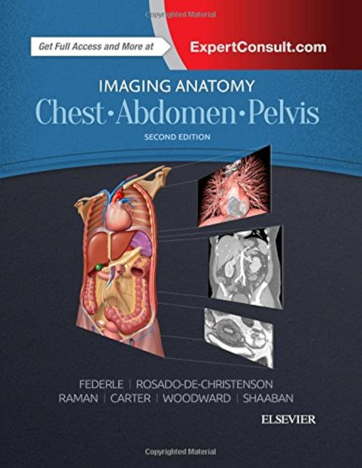 Imaging Anatomy: Chest, Abdomen, Pelvis - Michael P Federle MD  FACR