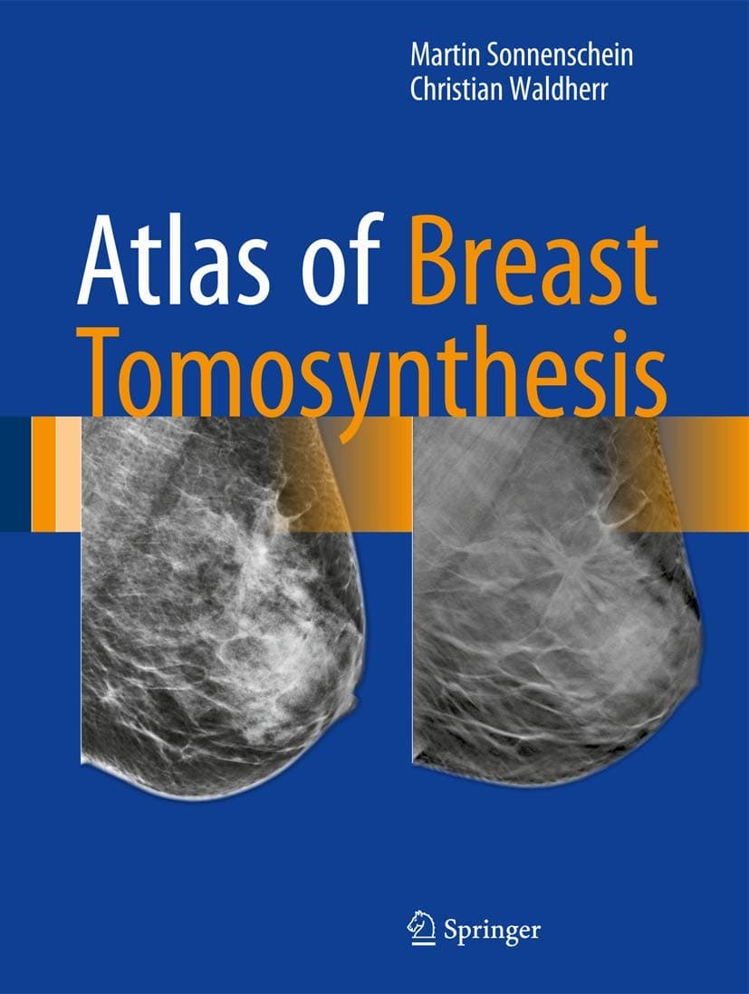 Atlas of Breast Tomosynthesis: Imaging Findings and Image-Guided Interventions - Springer