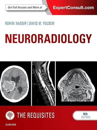 Neuroradiology: The Requisites (The Core Requisites) - David M. Yousem MD  MBA