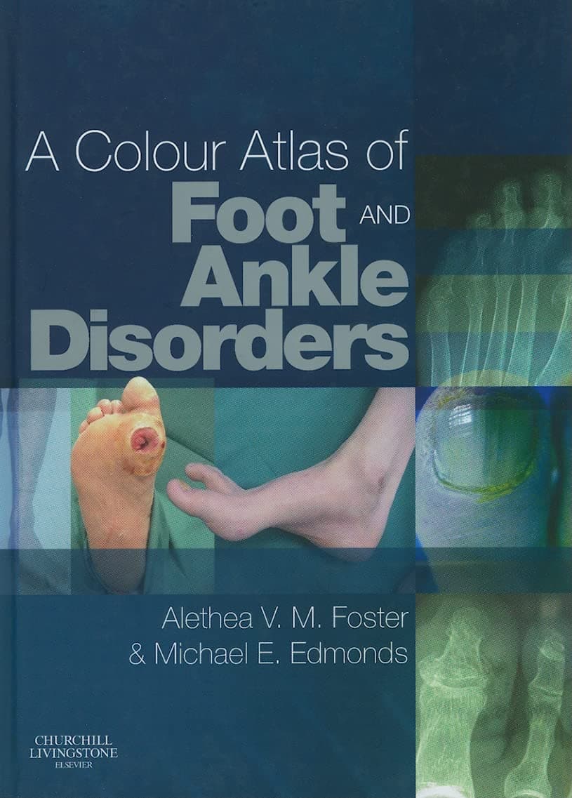 A Colour Atlas of Foot and Ankle Disorders - Alethea VM Foster BA(Hons)  PGCE  DPodM  MChS  SRCh