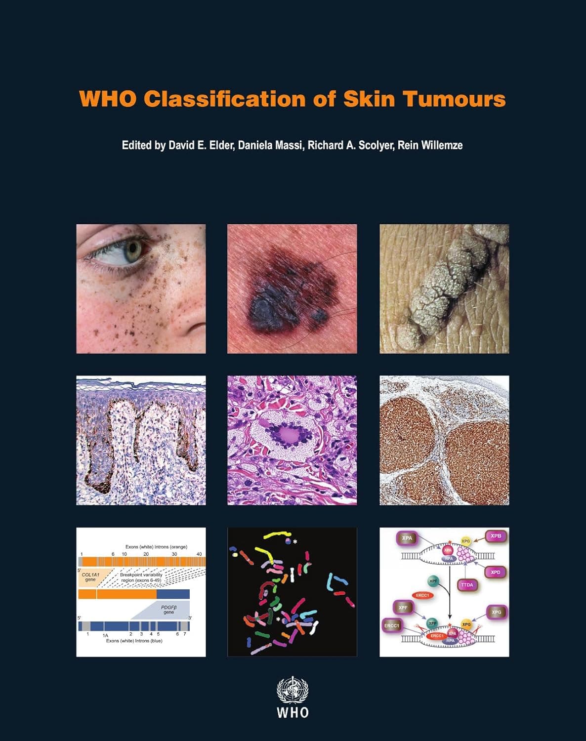 WHO Classification of Skin Tumours [OP] - WHO Classification of Tumours Editorial Board