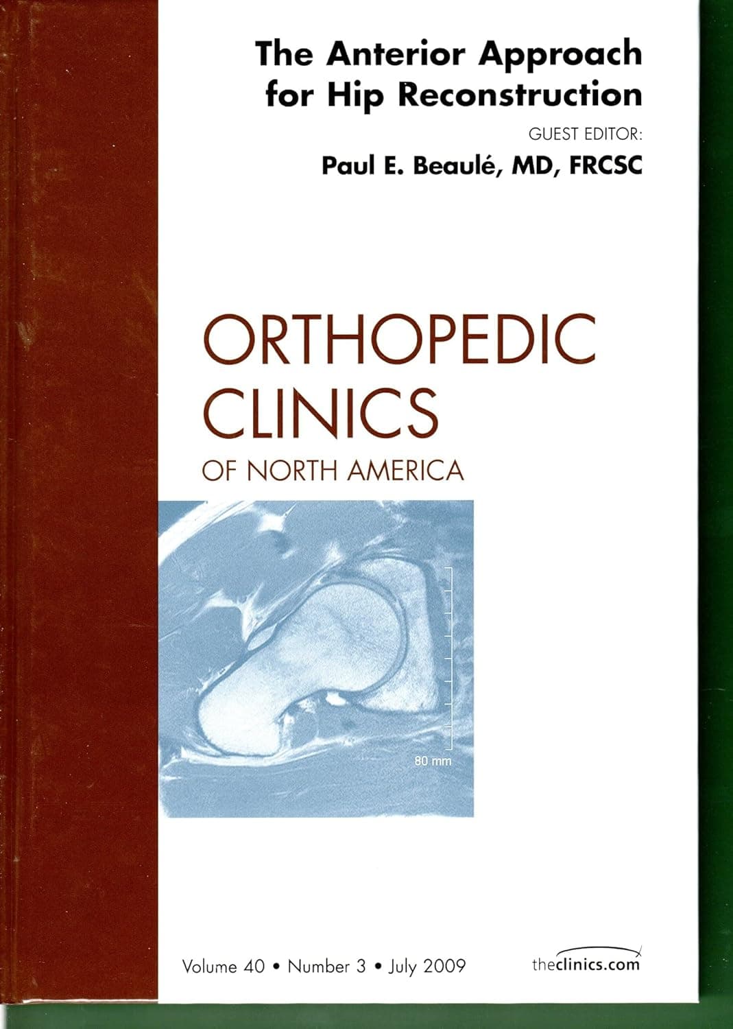 The Anterior Approach for Hip Reconstruction, An Issue of Orthopedic Clinics (Volume 40-3) (The Clinics: Orthopedics, Volume 40-3)
