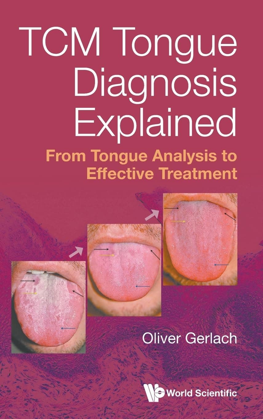 Tcm Tongue Diagnosis Explained: From Tongue Analysis To Effective Treatment - Oliver Gerlach