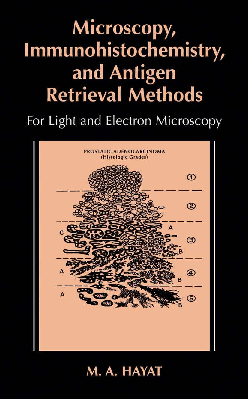 Microscopy, Immunohistochemistry, and Antigen Retrieval Methods: For Light and Electron Microscopy - M.A. Hayat