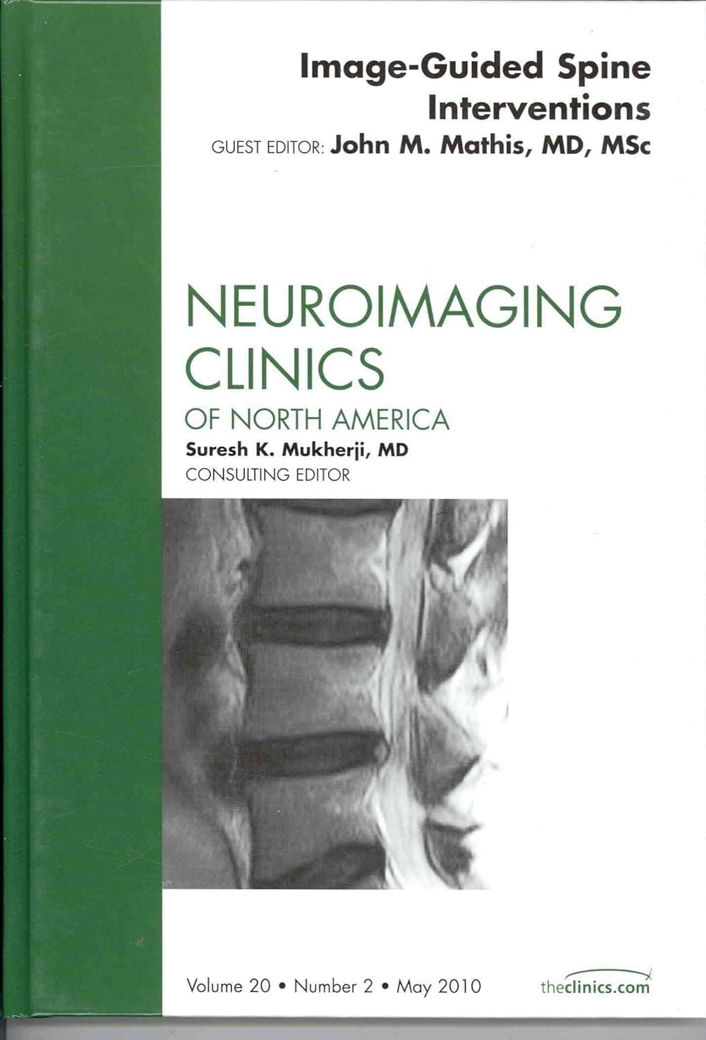 Image-Guided Spine Interventions, An Issue of Neuroimaging Clinics (Volume 20-2) (The Clinics: Radiology, Volume 20-2)