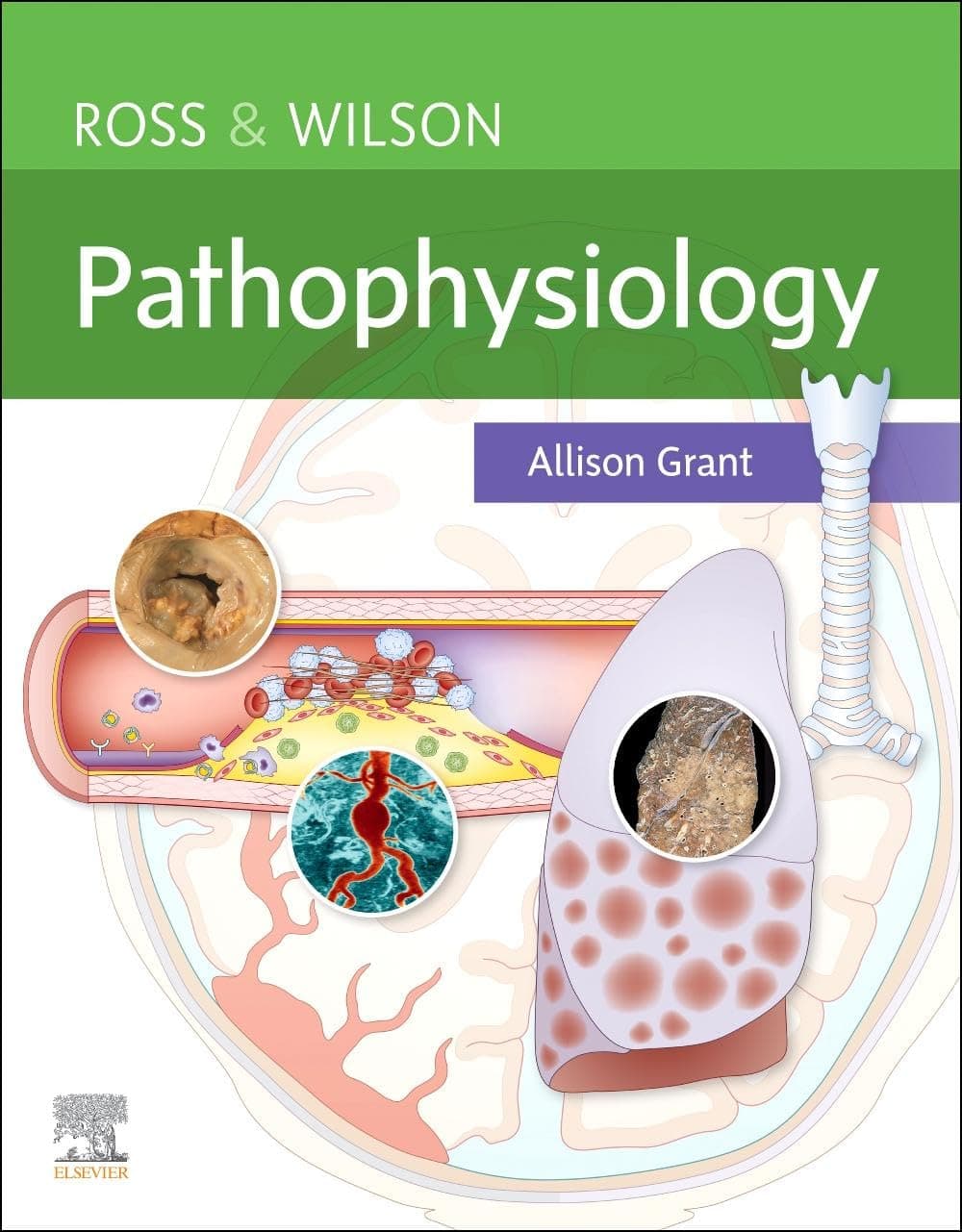 Ross & Wilson Pathophysiology - Ph.D. Ross