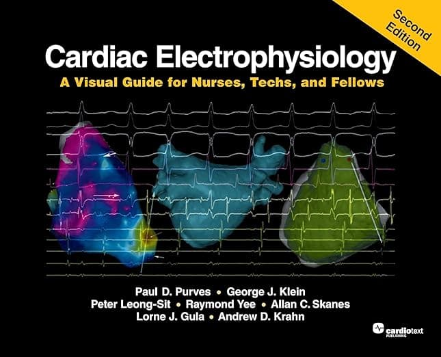 Cardiac Electrophysiology: A Visual Guide for Nurses, Techs, and Fellows, 2nd Edition - Paul D. Purves