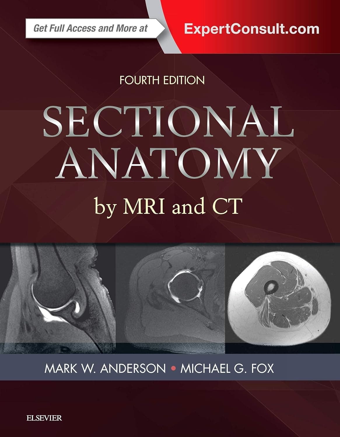 Sectional Anatomy by MRI and CT