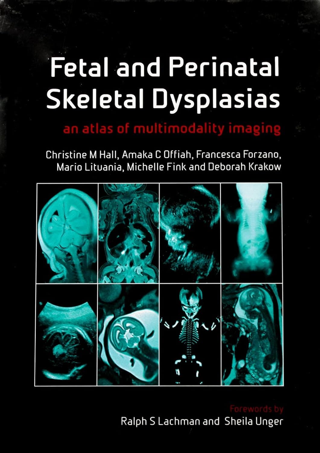 Fetal and Perinatal Skeletal Dysplasias: an Atlas of Multimodality Imaging