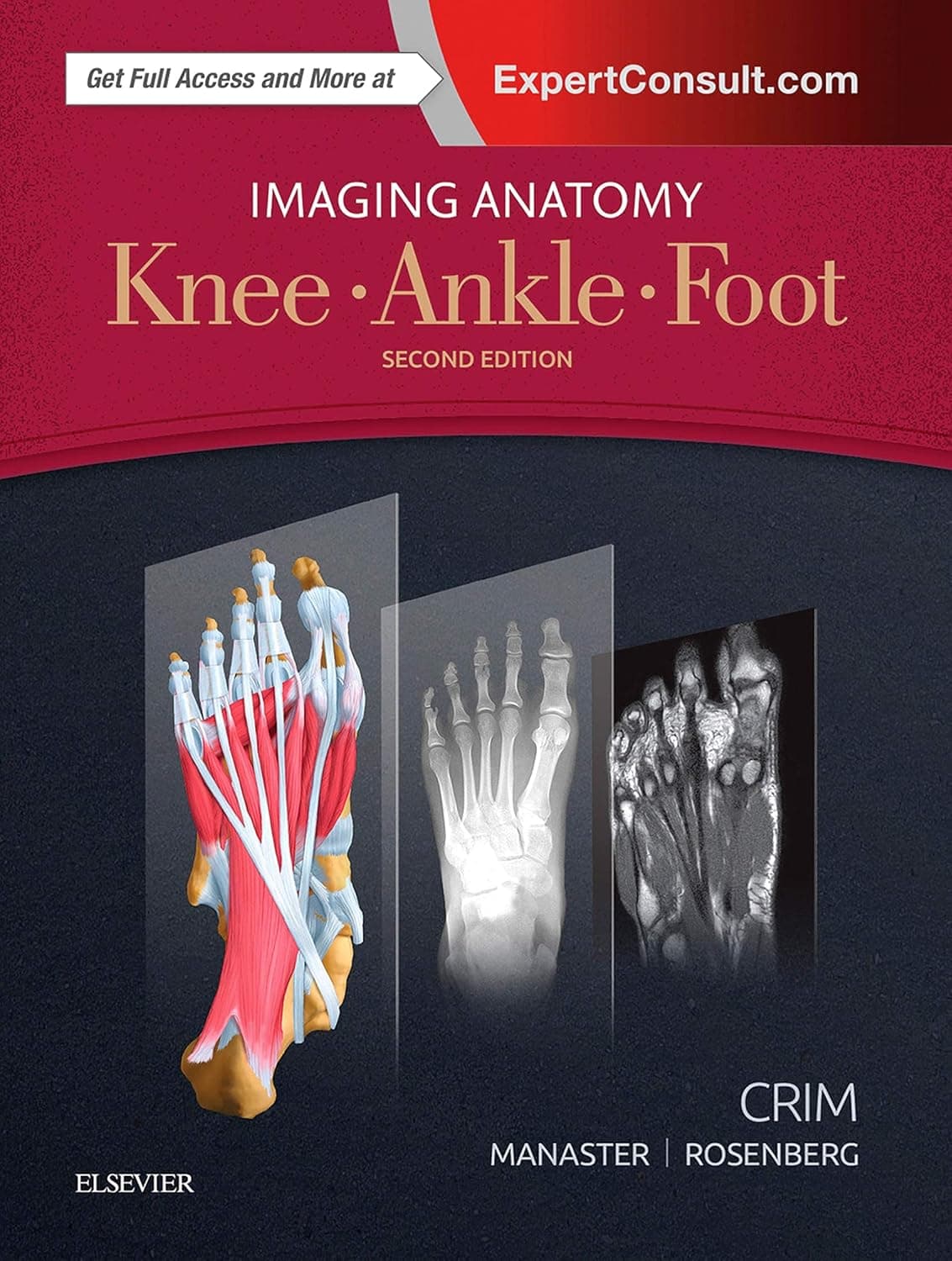 Imaging Anatomy: Knee, Ankle, Foot - Julia Crim MD