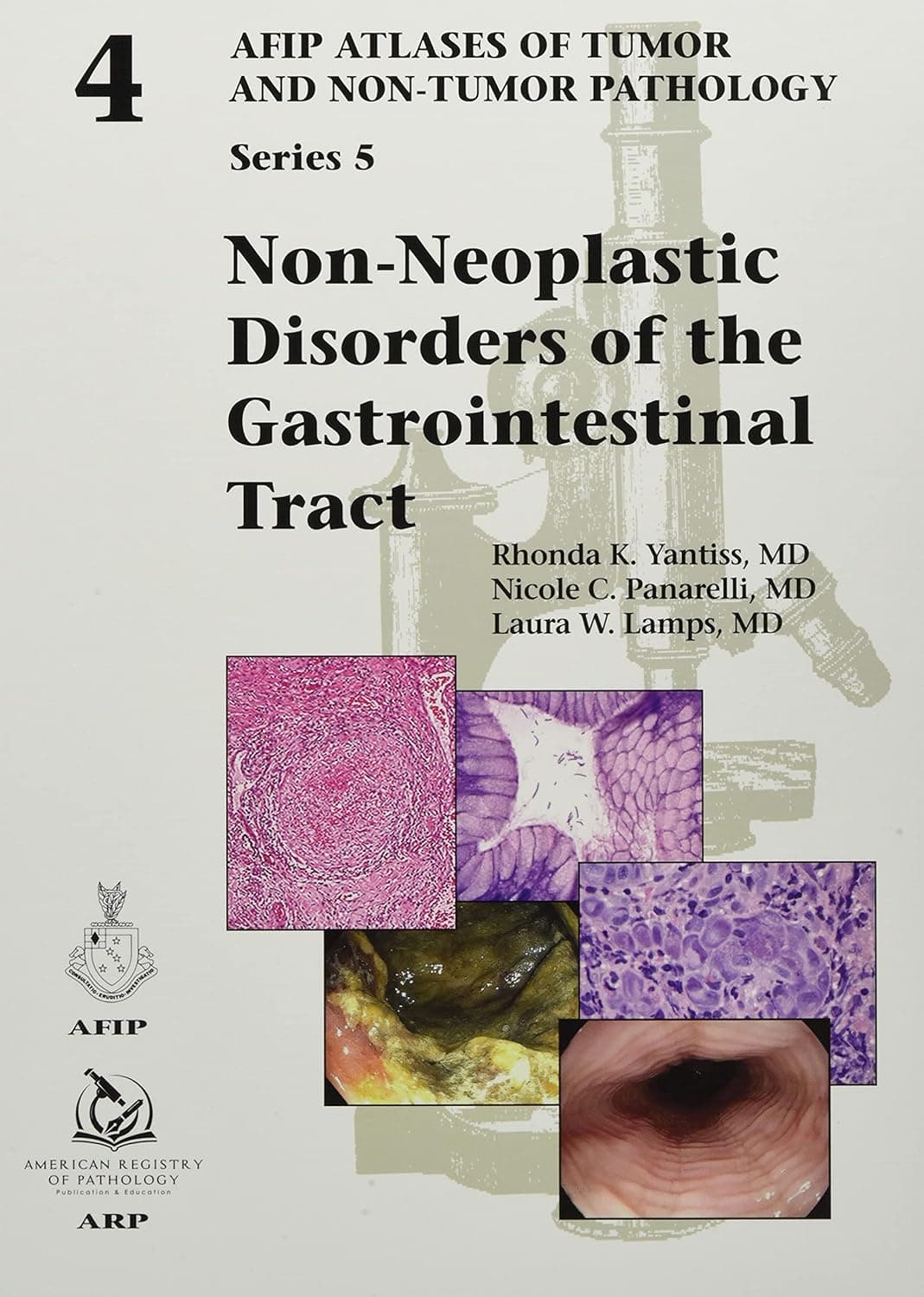 Non-Neoplastic Disorders of the Gastrointestinal Tract (AFIP Atlases of Tumor and Non-Tumor Pathology, Series 5) (AFIP Atlas of Tumor and Non-Tumor Pathology, Series 5) - Rhonda K. Yantiss (author)
