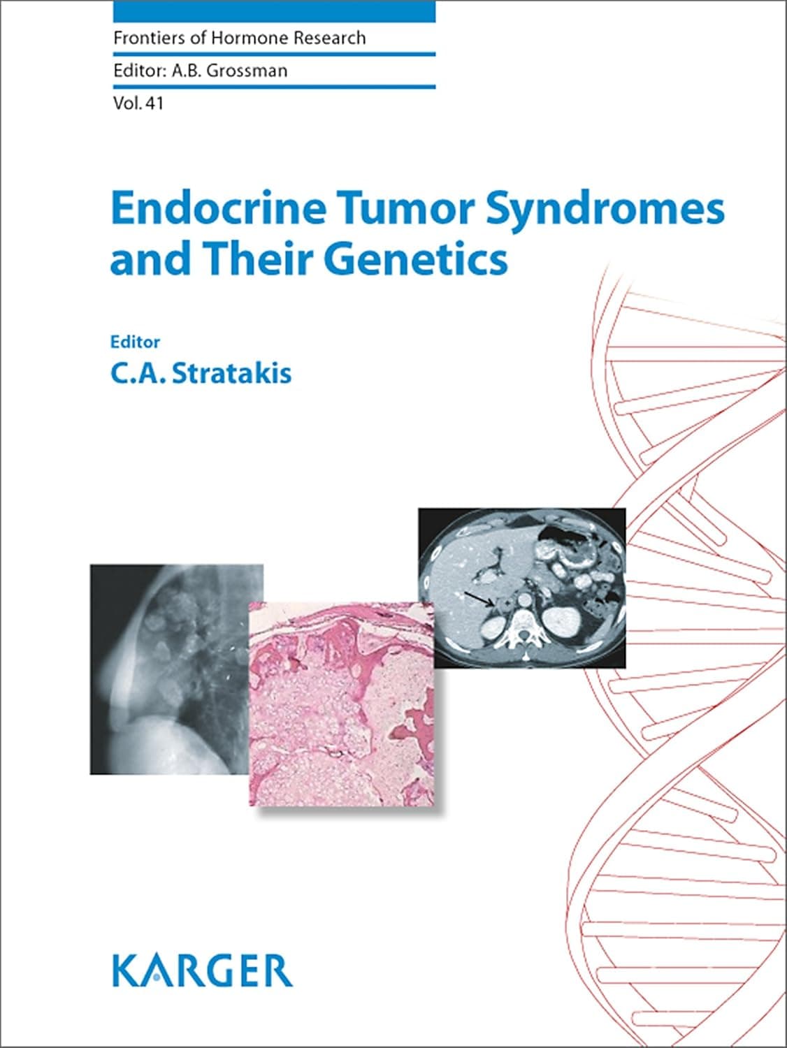 Endocrine Tumor Syndromes and Their Genetics (FRONTIERS OF HORMONE RESEARCH)