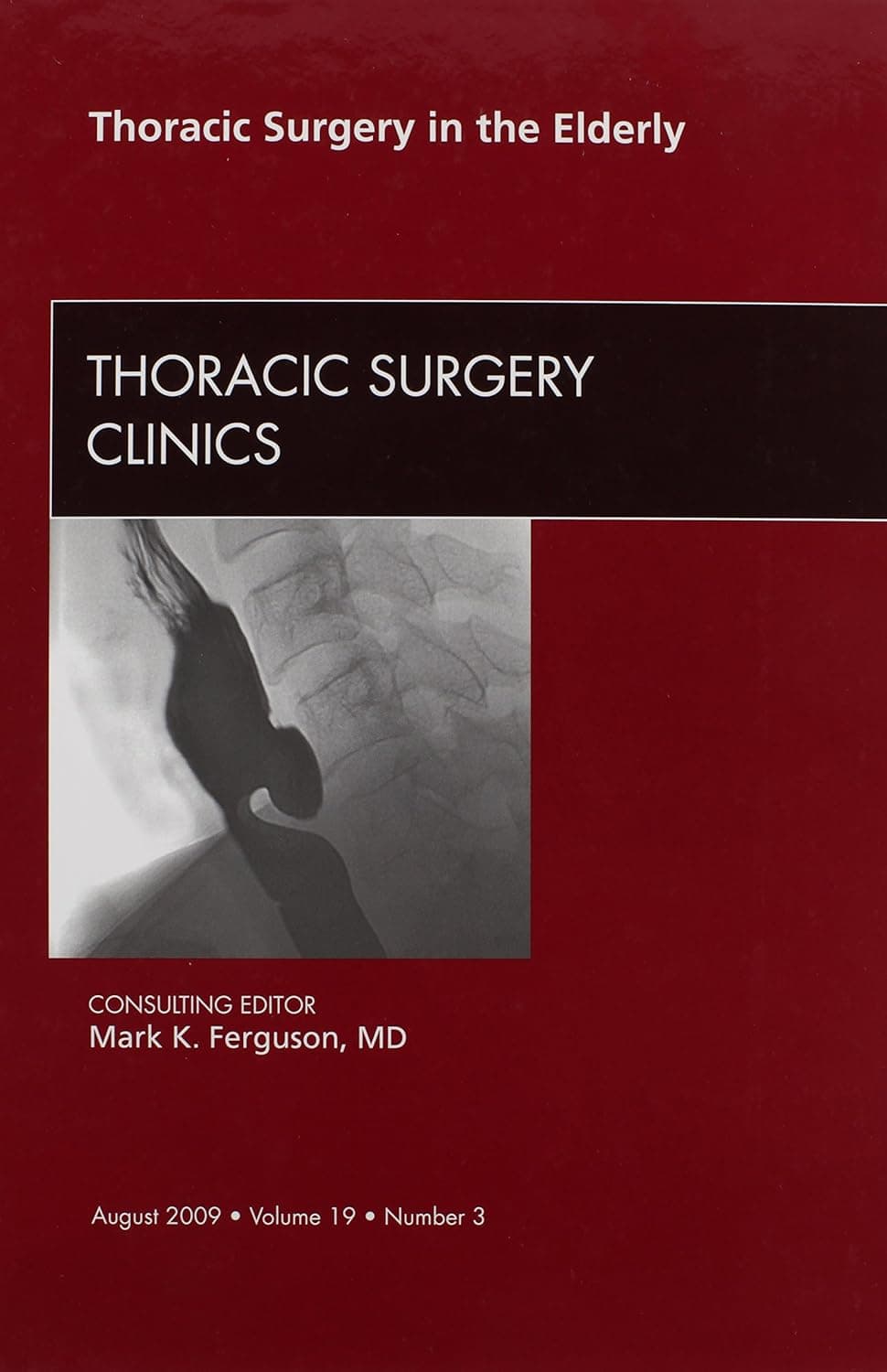 Thoracic Surgery in the Elderly, An Issue of Thoracic Surgery Clinics (Volume 19-3) (The Clinics: Surgery, Volume 19-3) - Mark K. Ferguson MD