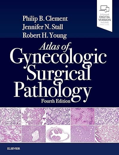 Atlas of Gynecologic Surgical Pathology: Expert Consult: Online and Print - Philip B. Clement MD