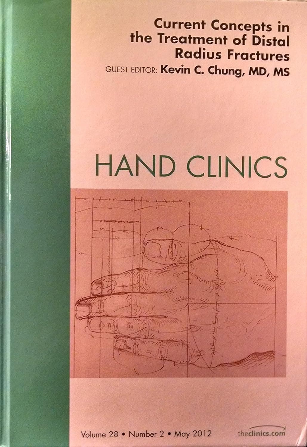 Current Concepts in the Treatment of Distal Radius Fractures, An Issue of Hand Clinics (Volume 28-2) (The Clinics: Orthopedics, Volume 28-2) - Kevin C. Chung MD  MS