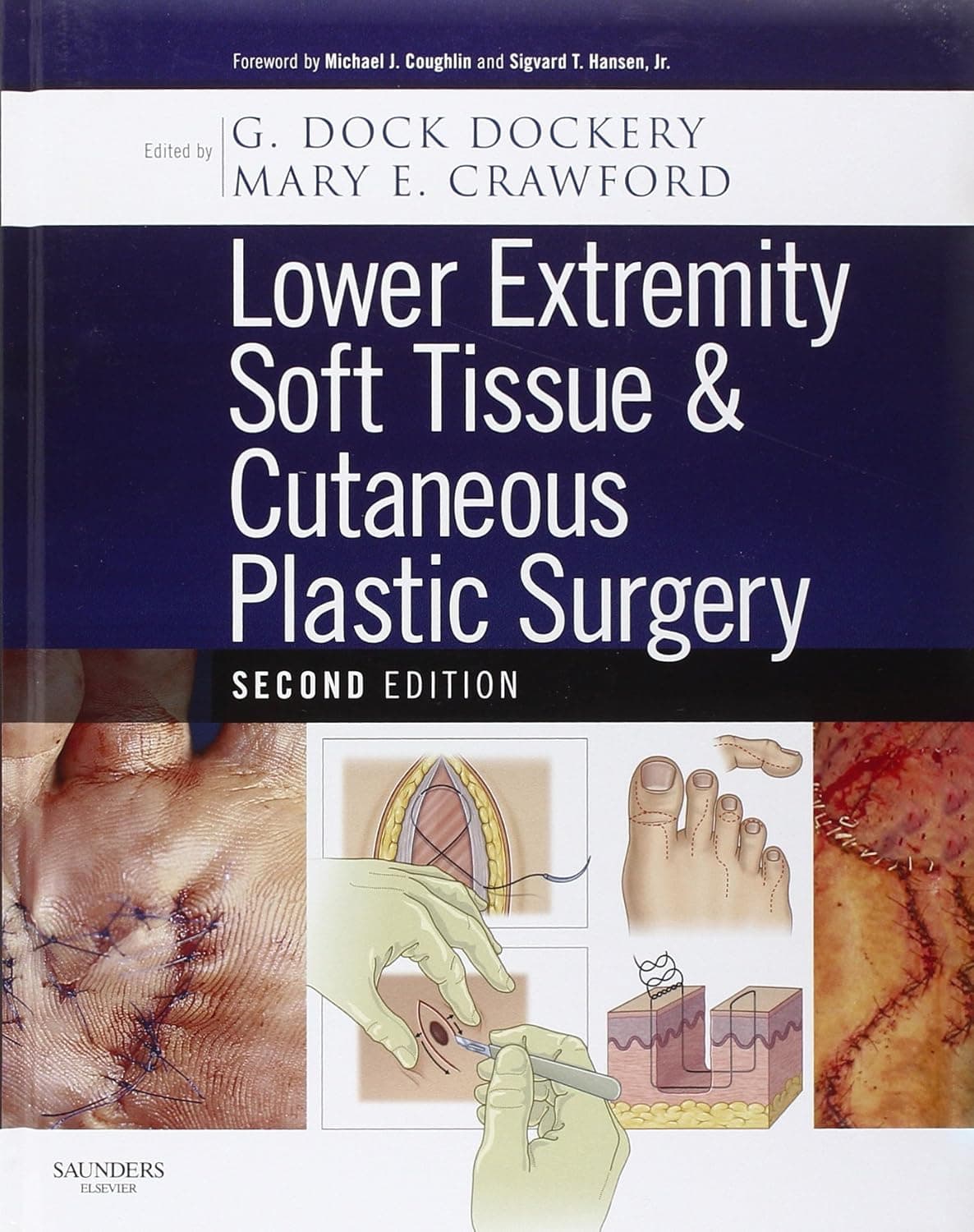 Lower Extremity Soft Tissue & Cutaneous Plastic Surgery - J. Hansen